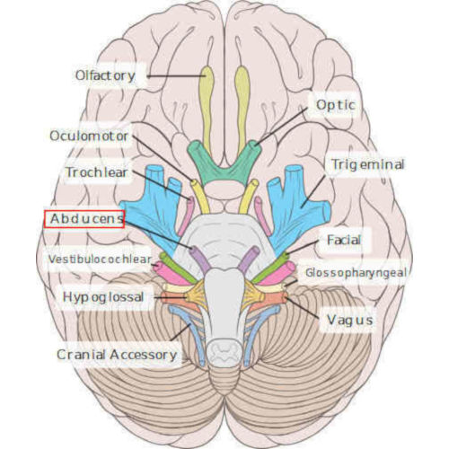 emergenza VI nervo cranico