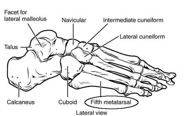 Metatarso
