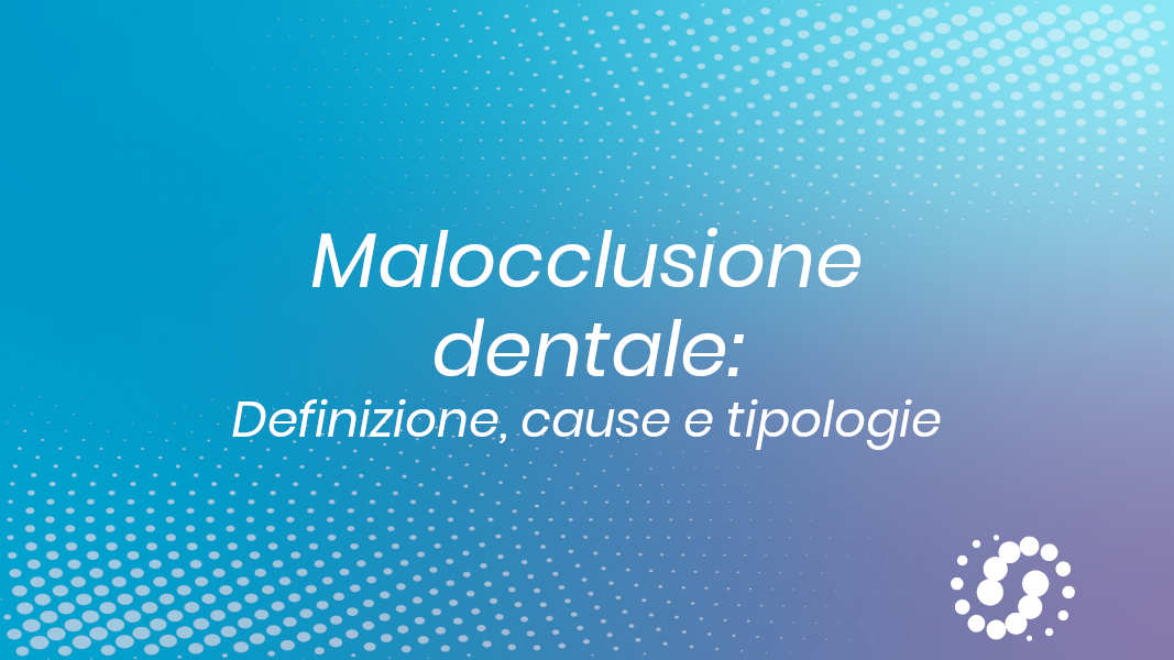 Malocclusione dentale: definizione, cause e tipologie di malocclusione