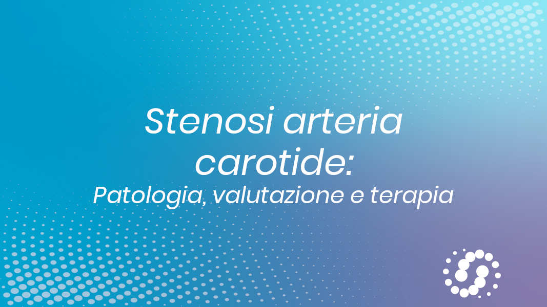 Stenosi arteria carotide: la patologia, valutazione, terapia