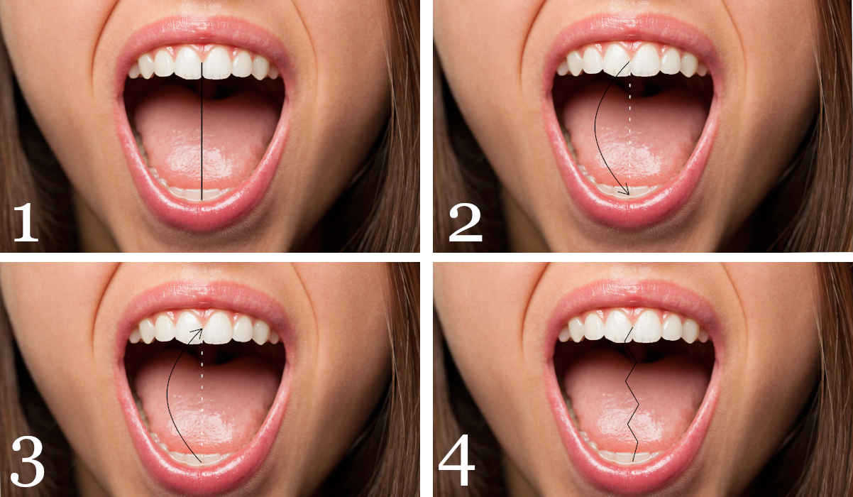 Tipologie di aperture della bocca