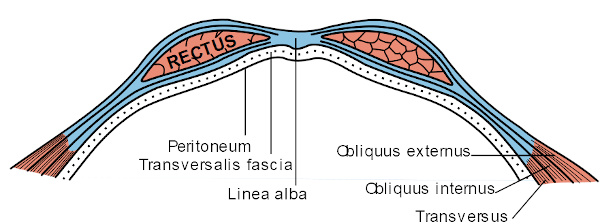 Guaina dei muscoli retti dell'addome